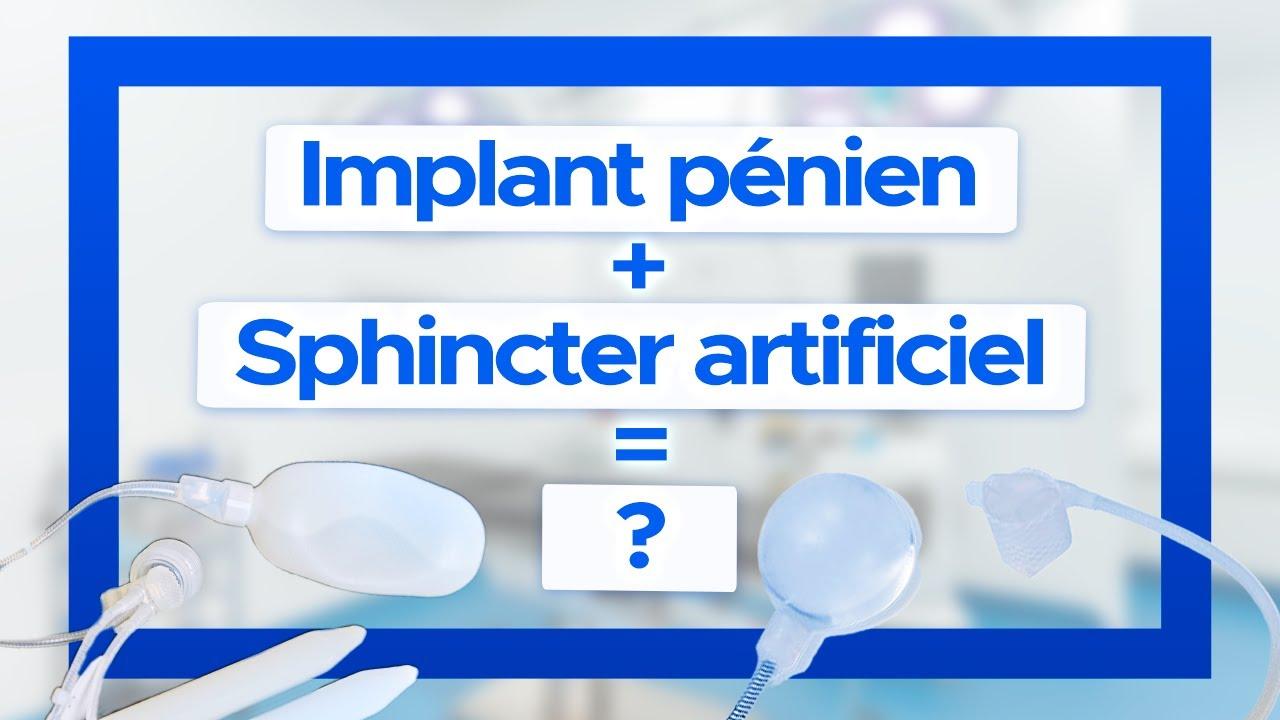 penile implant in the presence of an artificial sphincter